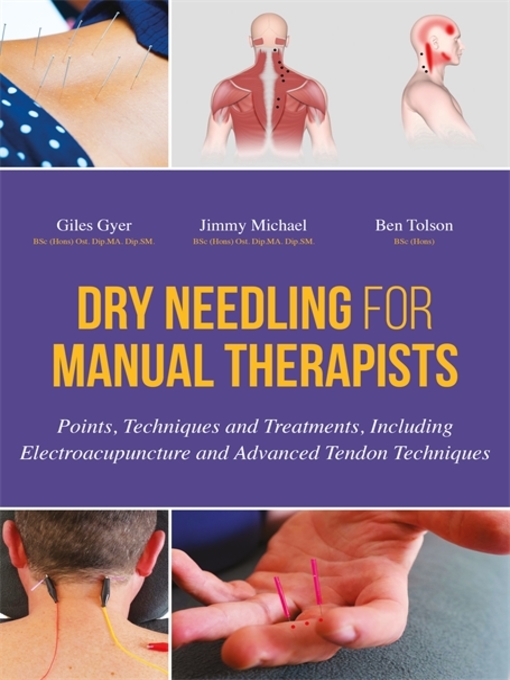 Title details for Dry Needling for Manual Therapists by Giles Gyer - Available